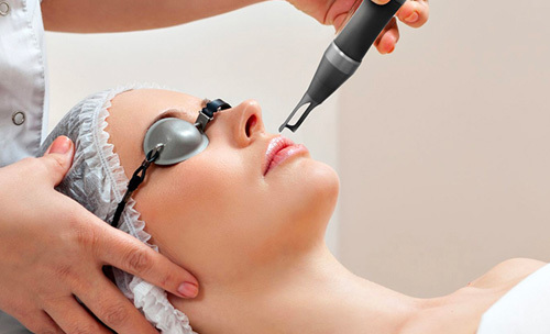 Laser skin resurfacing 